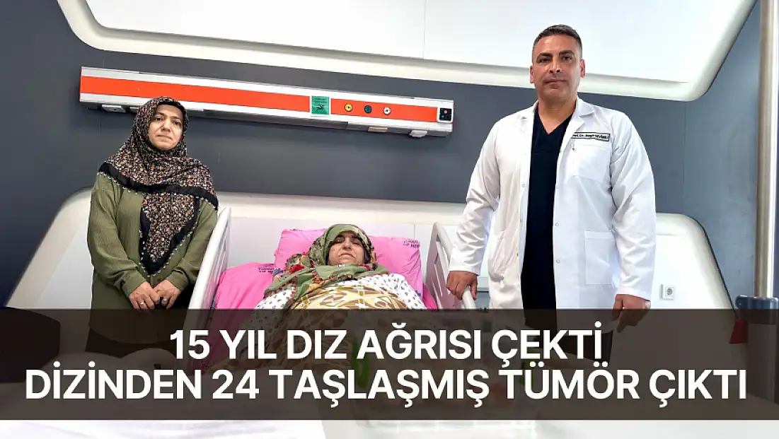 15 Yıl Diz Ağrısı Çekti, Dizinden 24 Taşlaşmış Tümör Çıktı