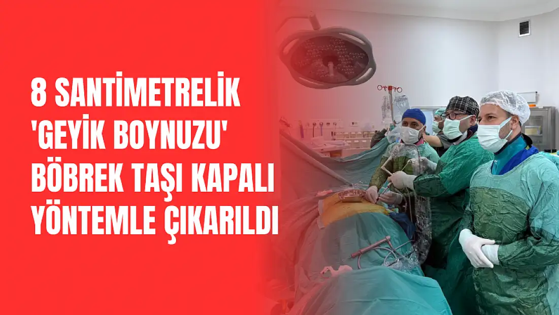 8 santimetrelik 'geyik boynuzu' böbrek taşı kapalı yöntemle çıkarıldı