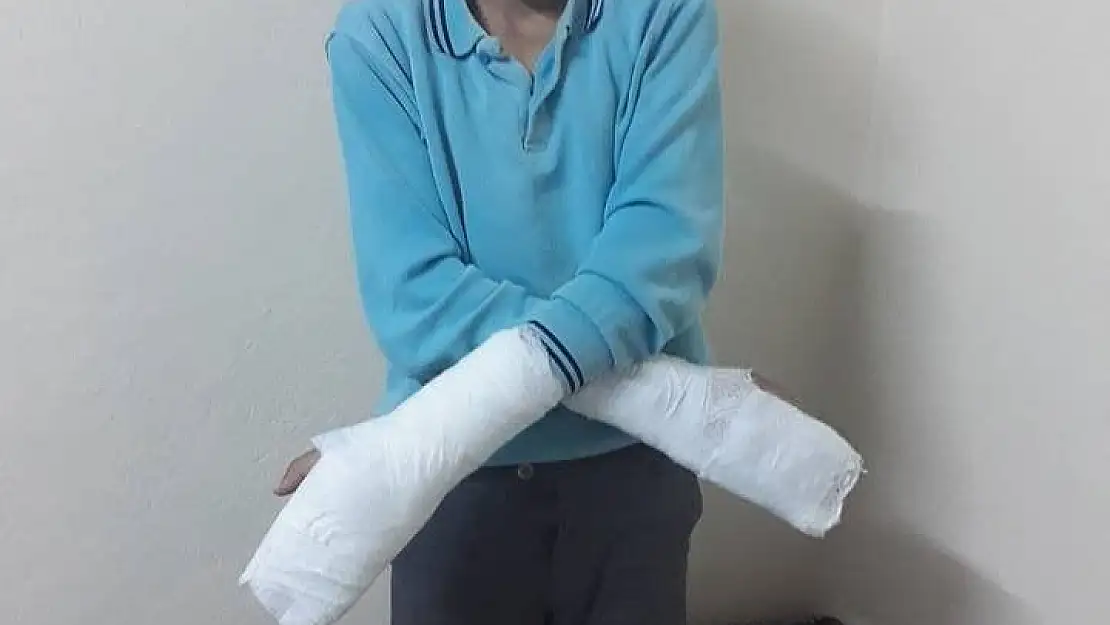 'Müdürün okuldan kaçtı diye öğrencinin parmaklarını kırdığı iddiası'