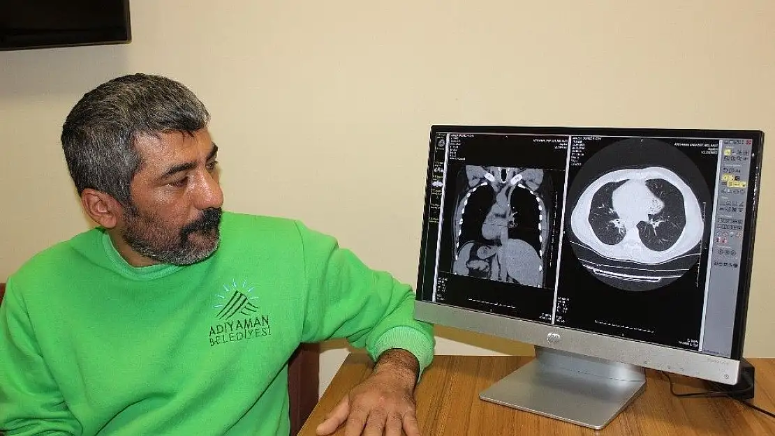 'Organları ters tarafta olan adam duyanları şaşırtıyor'