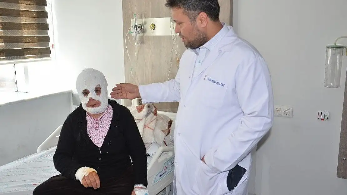 'Elbistan Devlet Hastanesi Yanık Odası, 443 hastaya hizmet verdi'