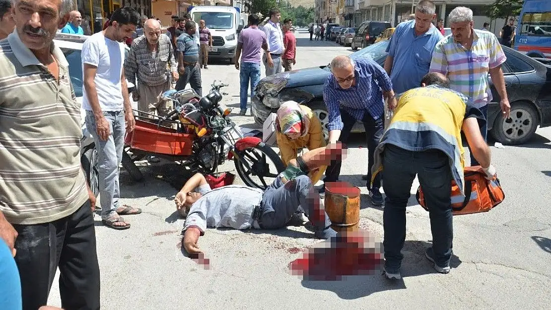 'Kazada motosiklet sürücüsünün ayağı koptu'