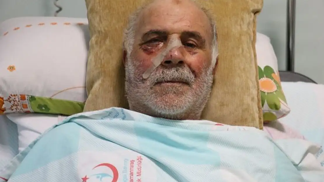 'Demir keserken yüzünü parçaladı'