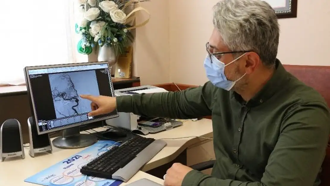 'Her 6 saniyede 1 kişi inme geçiriyor, saatte 1 kişi hayatını kaybediyor'