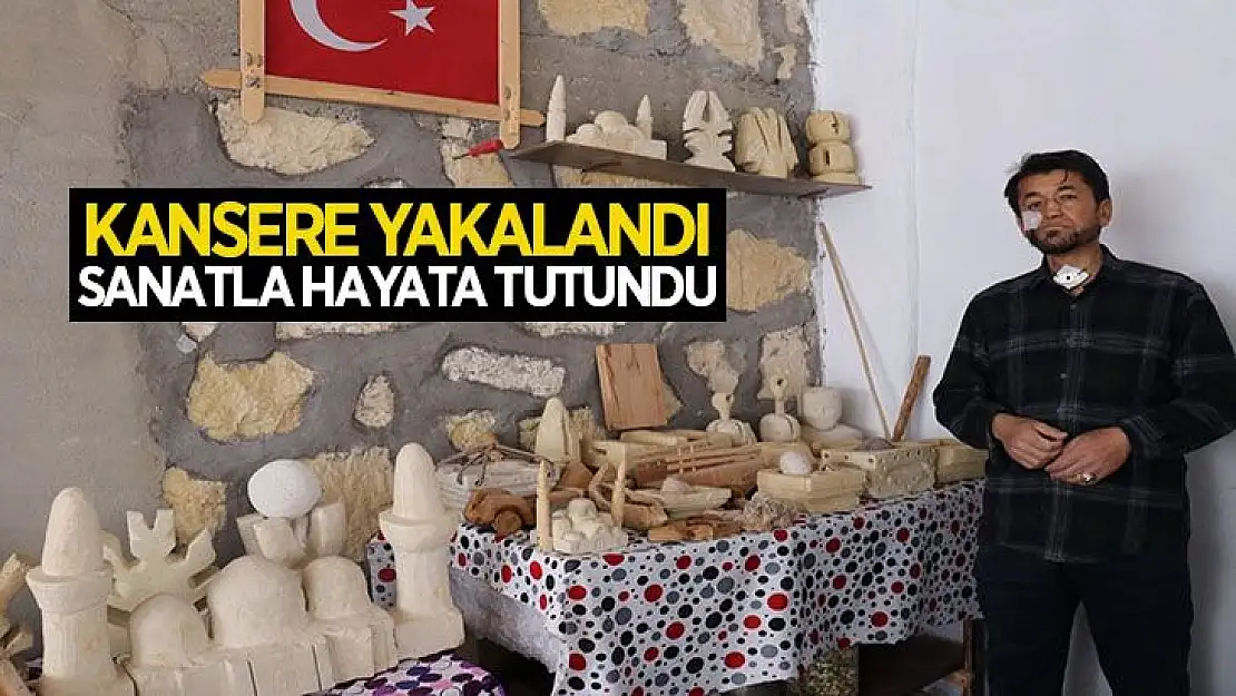 Kansere yakalandı, sanatla hayata tutundu
