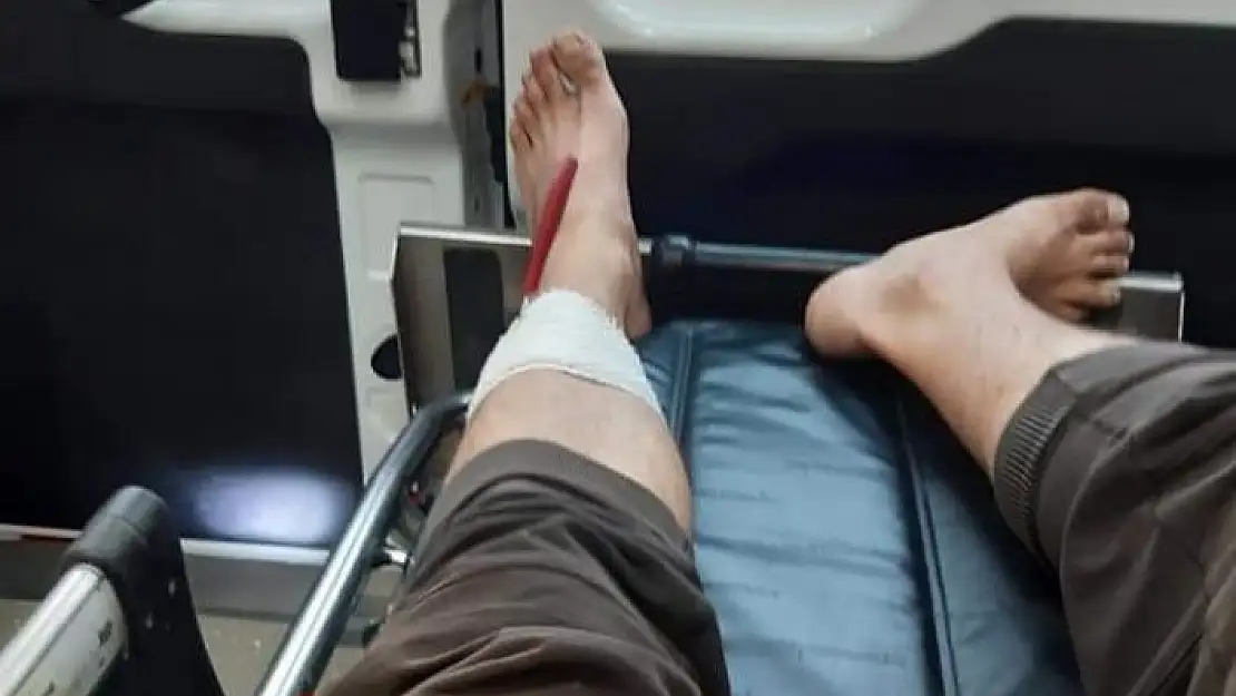 'Koli bantlarken bıçağı baldırına sapladı'