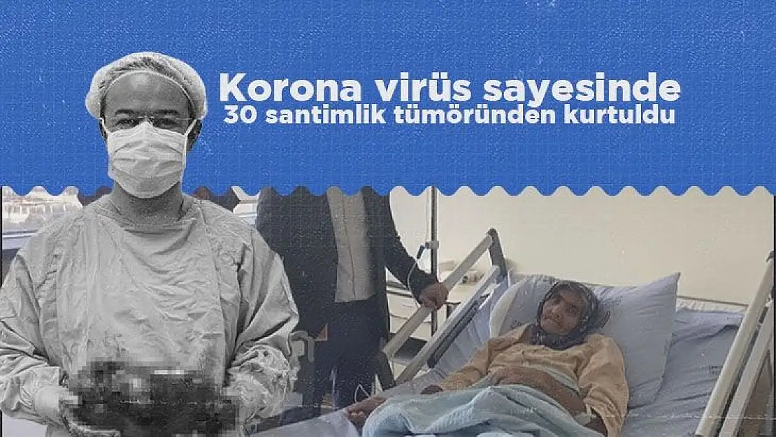 Korona virüs sayesinde 30 santimlik tümöründen kurtuldu