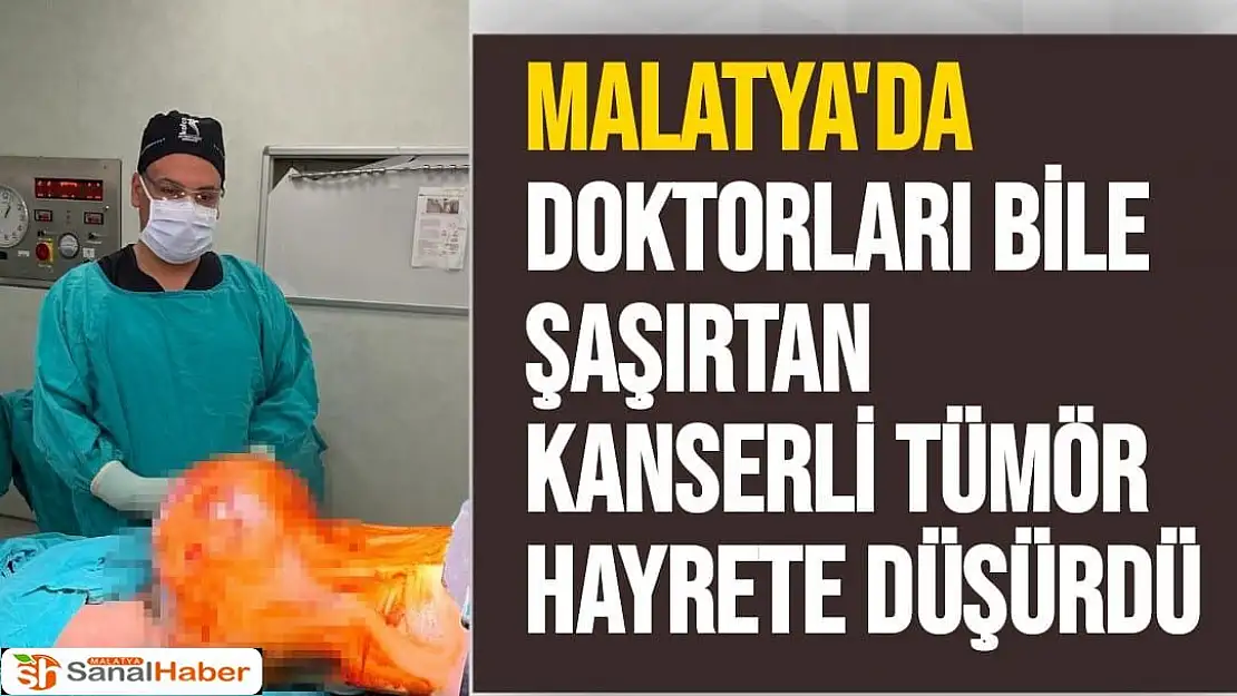 Malatya'da Doktorları bile şaşırtan kanserli tümör hayrete düşürdü