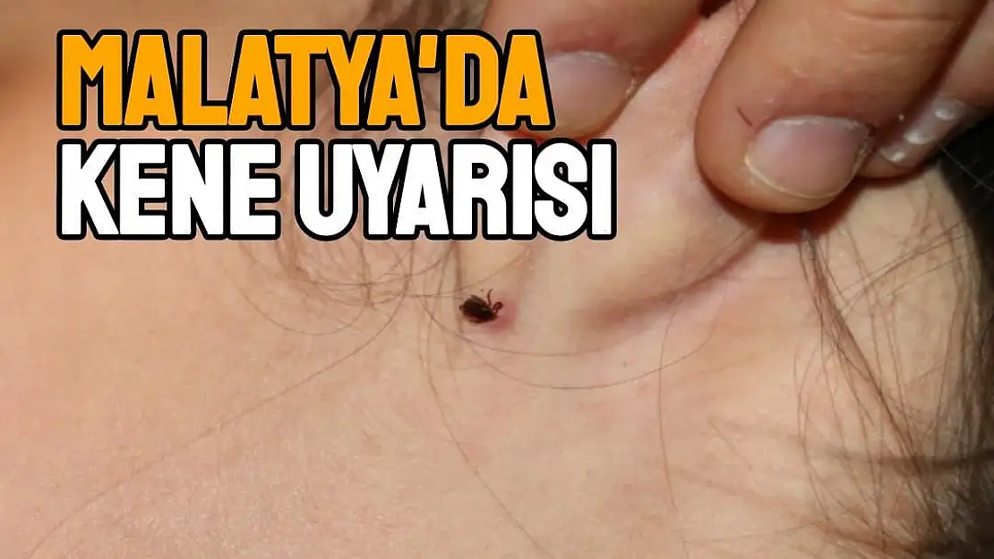 Malatya´da kene uyarısı