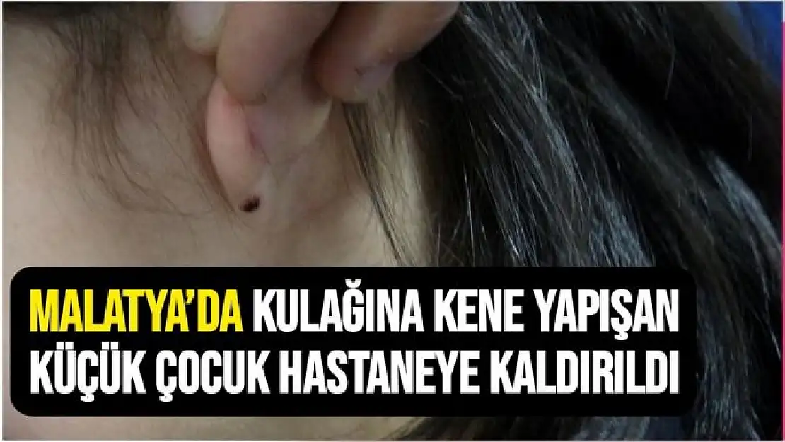 Malatya´da Kulağına kene yapışan küçük çocuk hastaneye kaldırıldı