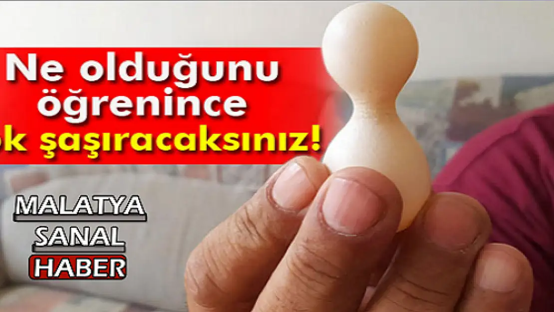 NE OLDUĞUNU ÖĞRENİNCE ÇOK ŞAŞIRACAKSINIZ!