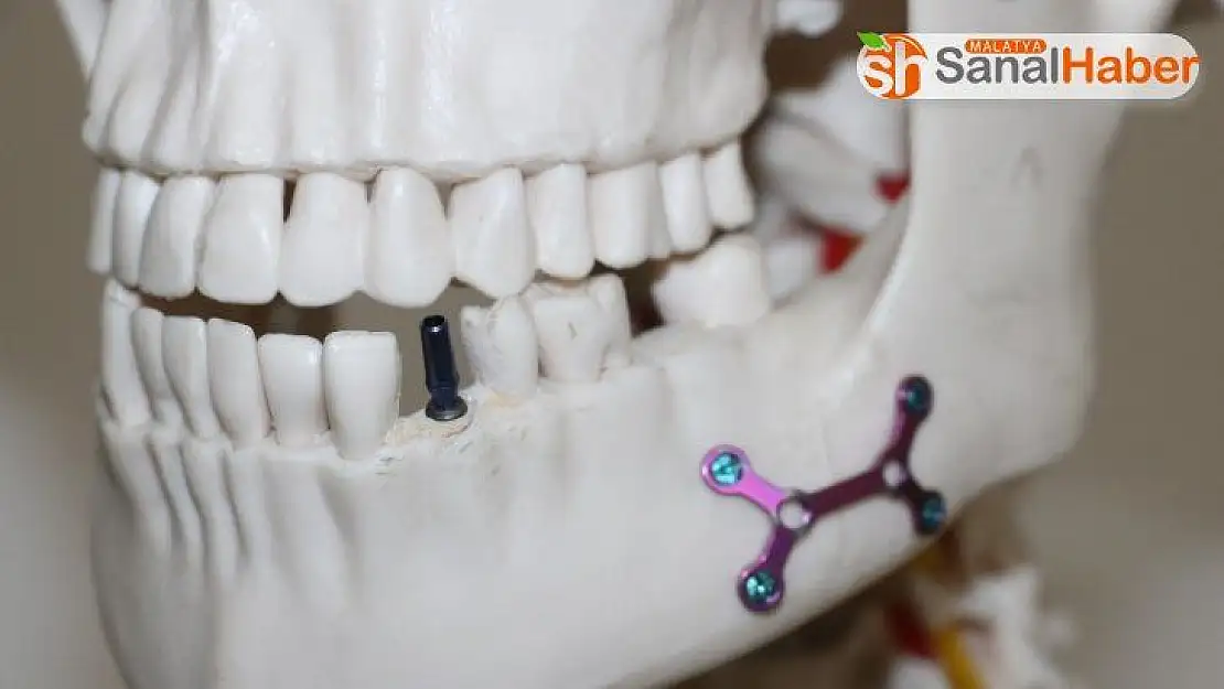 Otomobil parçası üreten Türk firması, diş implantında dışa bağımlılığa son verdi