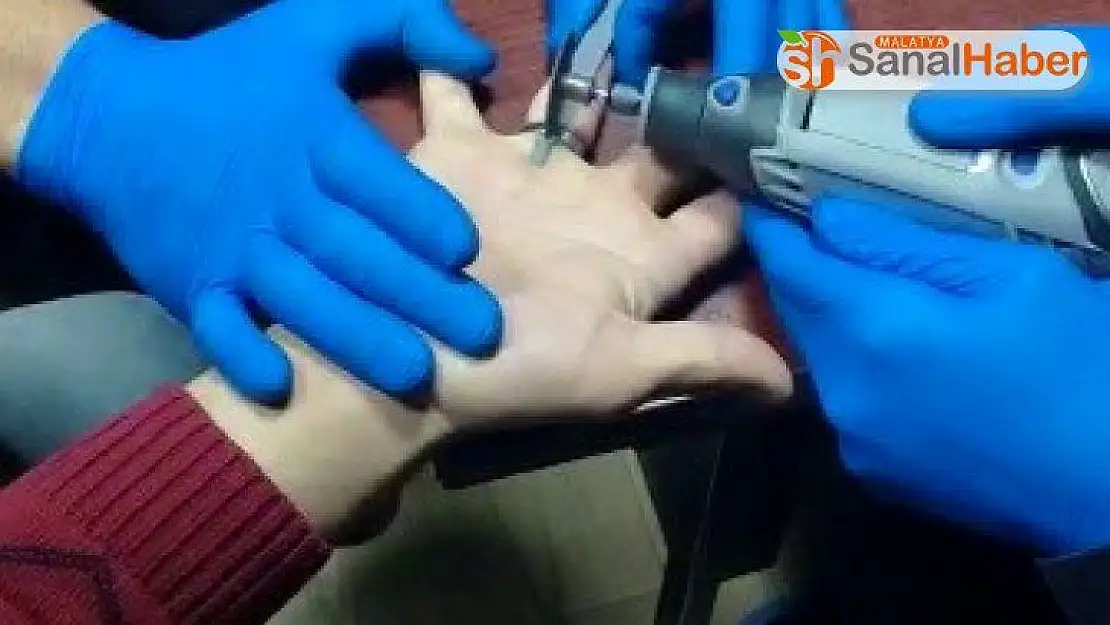 Parmağa sıkışan yüzük kesilerek çıkarıldı