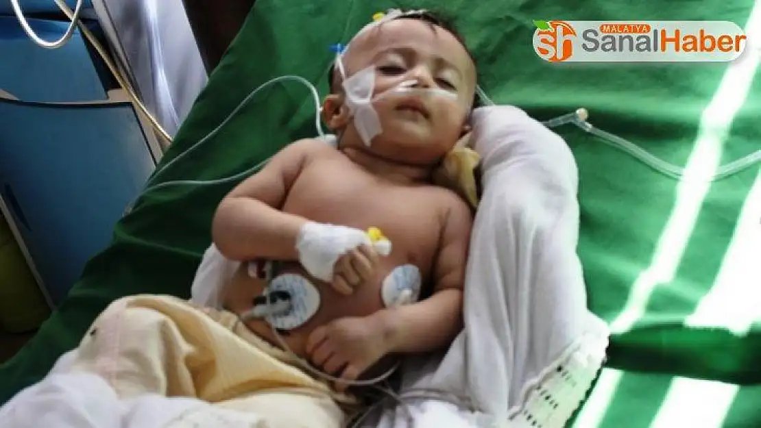 UNICEF: '400 binden fazla Yemenli çocuk, ileri derecede yetersiz beslenme sorunu yaşıyor'