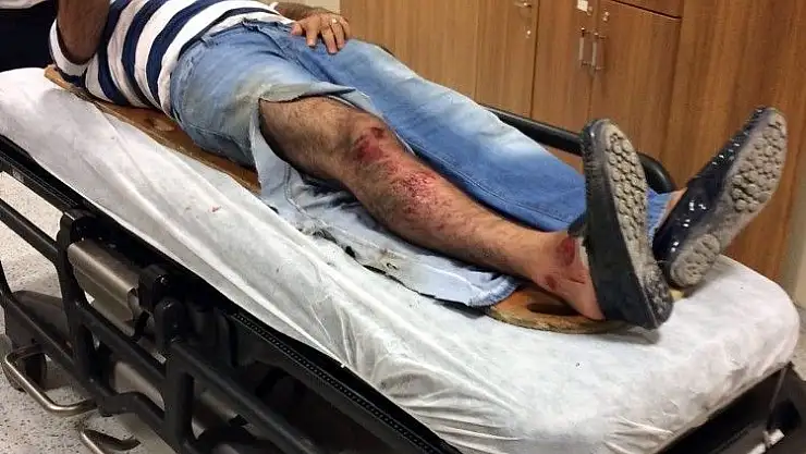 'Polisin yakaladığı şahıs kazaya neden oldu: 1´i polis 2 yaralı'