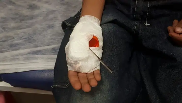 'Eline saplanan şişle hastaneye getirildi'