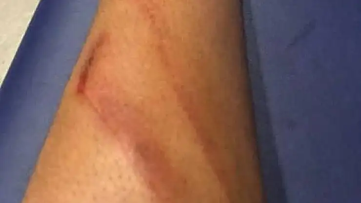 Aytaç Kara´dan maçın hakemine fotoğraflı tepki