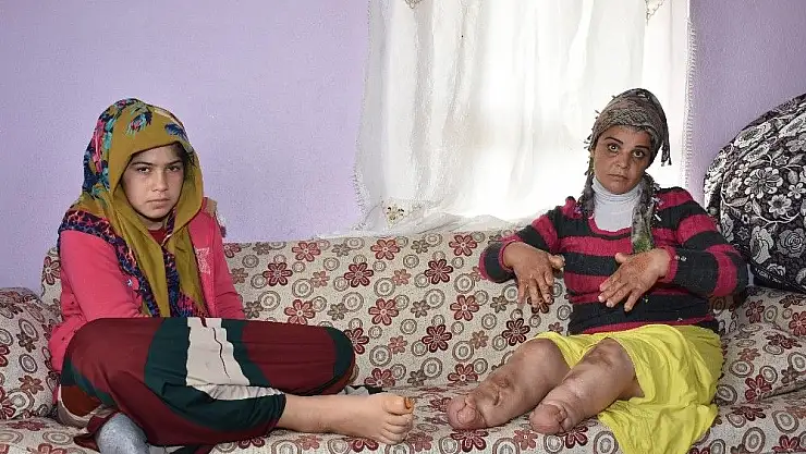 'Elleri ve kolları her geçen gün eriyor'