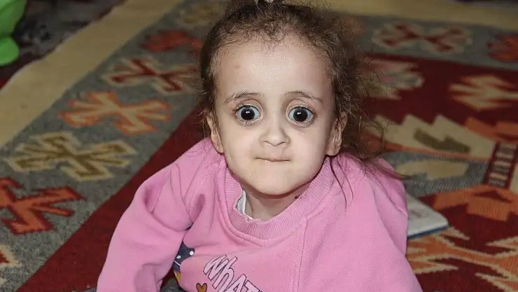 '100 binde 1 kişide görülen hastalıkla mücadele ediyorlar'