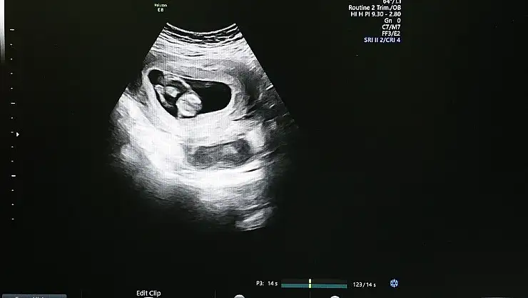 'Riskli gebeliklerin takibi kolaylıkla yapılabilecek'