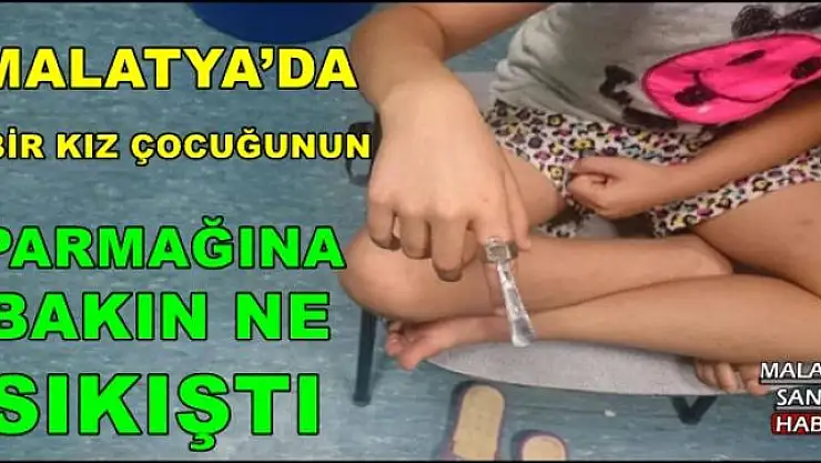 MALATYA´DA BİR KIZ ÇOCUĞUNUN PARMAĞINA BAKIN NE   SIKIŞTI