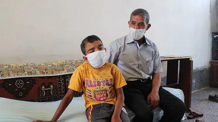 'Bir gözünü kaybetti, 10 ameliyat geçirdi, 2 operasyonu kaldı'