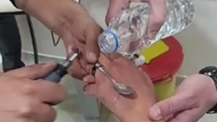 'Elazığ´da itfaiyeden yüzük çıkarma operasyonu'