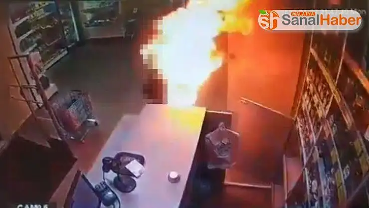 Eski karısını üzerine benzin döküp yaktı