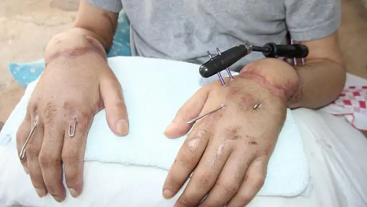 'Kestirmediği ellerini yeniden kullanmak istiyor'