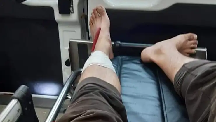 'Koli bantlarken bıçağı baldırına sapladı'