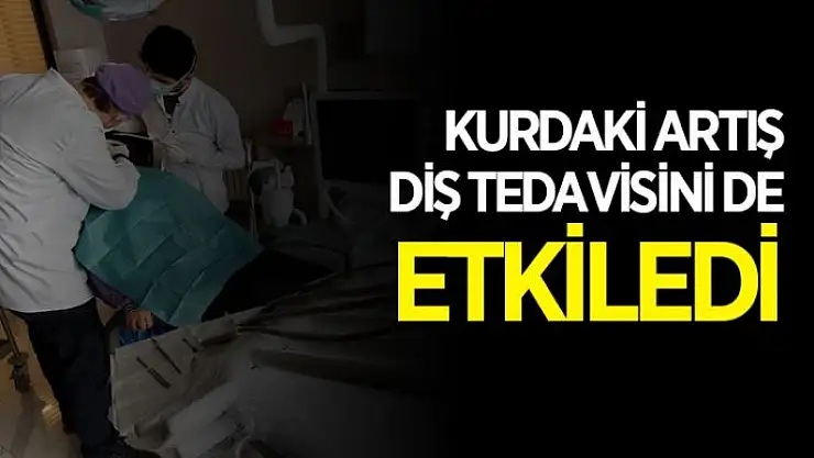 Kurdaki artış diş tedavisini de etkiledi
