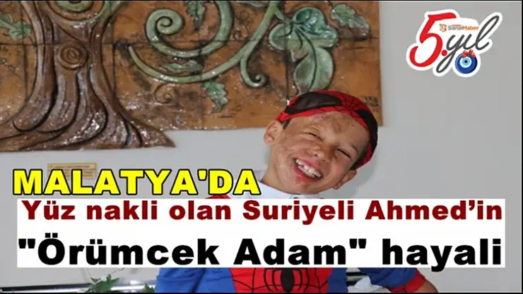 'Malatya'da Yüz nakli olan Suriyeli Ahmed´in ''Örümcek Adam'' hayali'