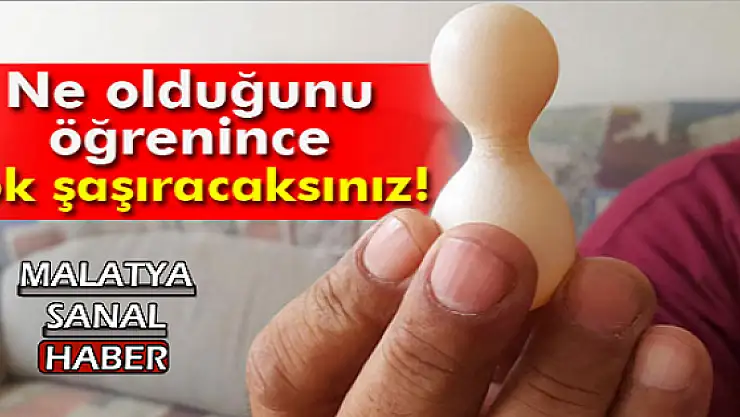 NE OLDUĞUNU ÖĞRENİNCE ÇOK ŞAŞIRACAKSINIZ!