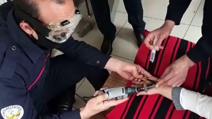 'Parmağa sıkışan yüzük kesilerek çıkarıldı'