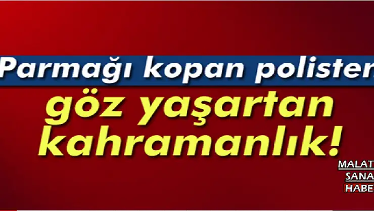 Parmağı kopan polisten göz yaşartan kahramanlık