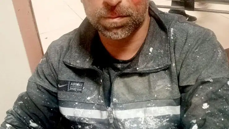 'Sokak köpekleri iki kişiyi yaraladı'