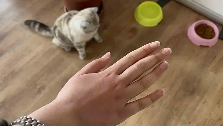 'Uzmanı uyardı: Her yıl giderek artıyor'